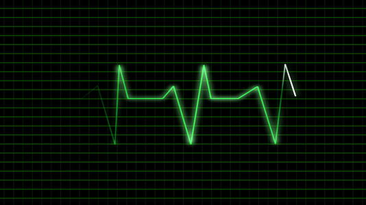 ecg心脏脉冲视频的预览图