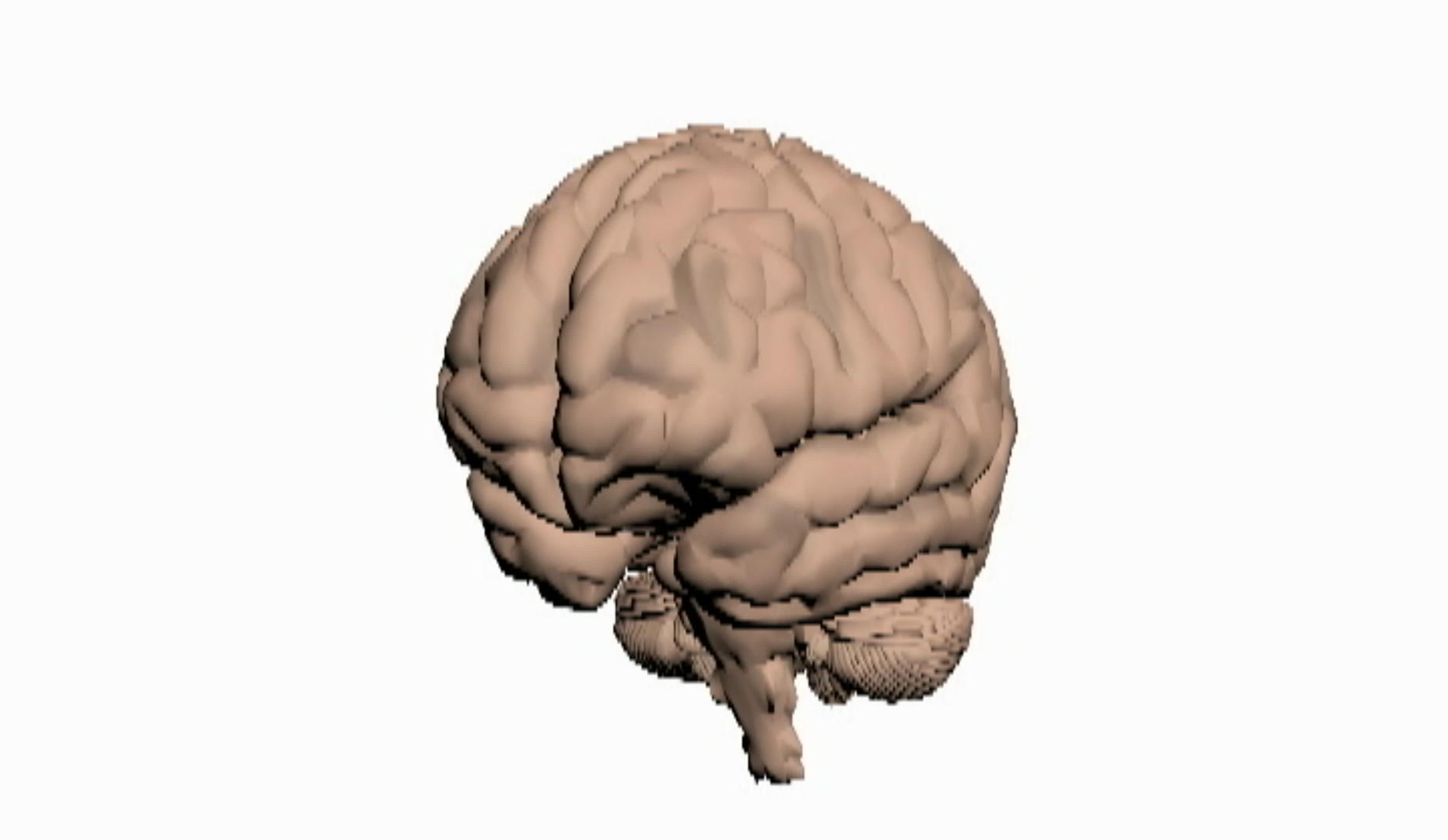 人脑视频的预览图