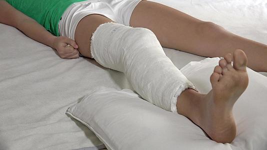 4000名患者在医院床上用石膏中断了他们的腿视频的预览图