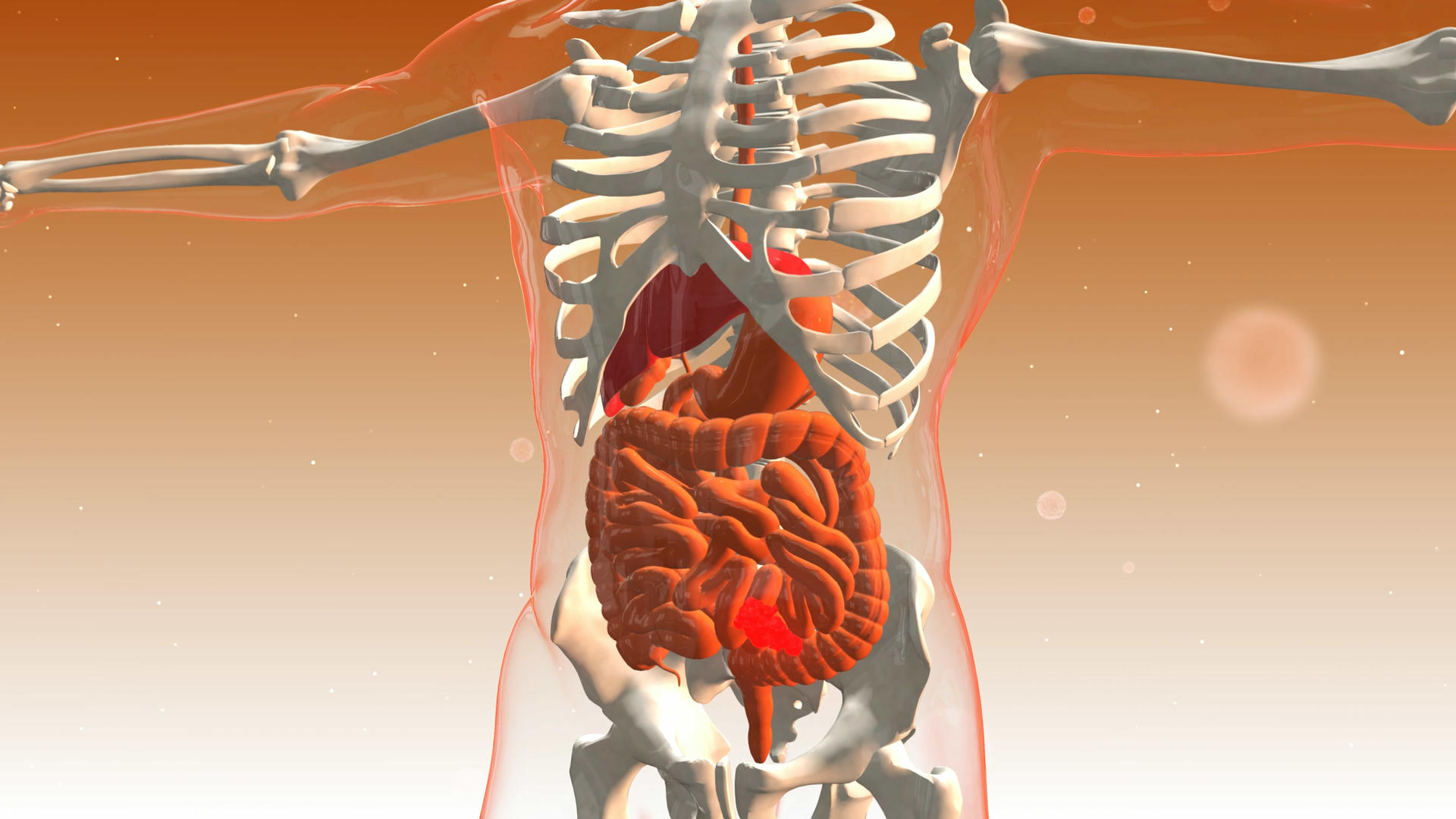 4K三维人体肠道病灶背景素材视频的预览图