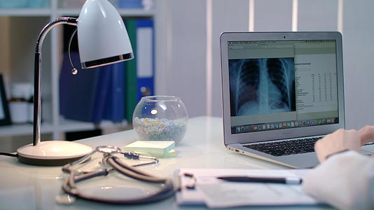 医生在工作场所用笔记本电脑做X光检查视频的预览图