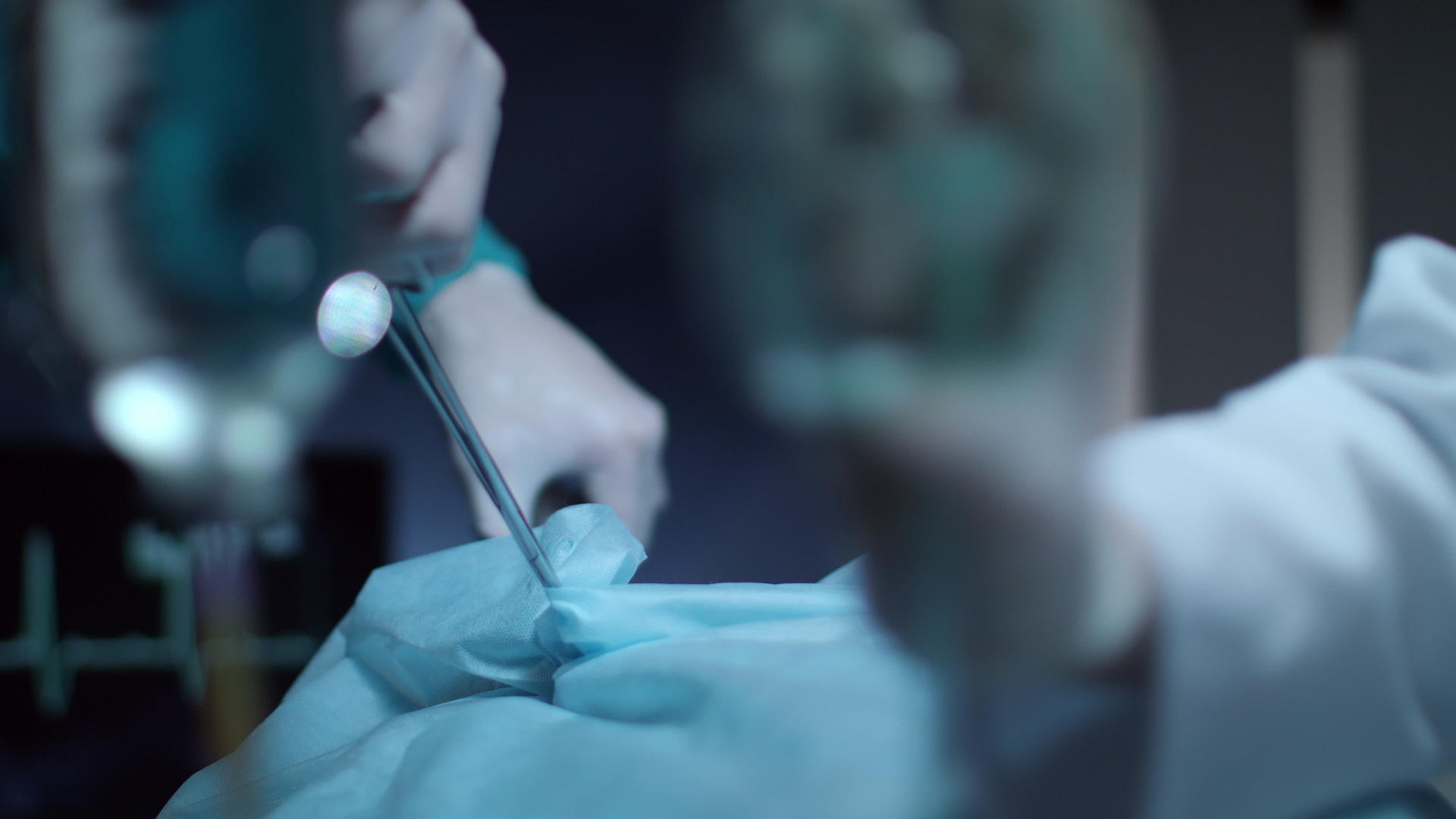 手术期间外科患者呼吸氧气罩视频的预览图