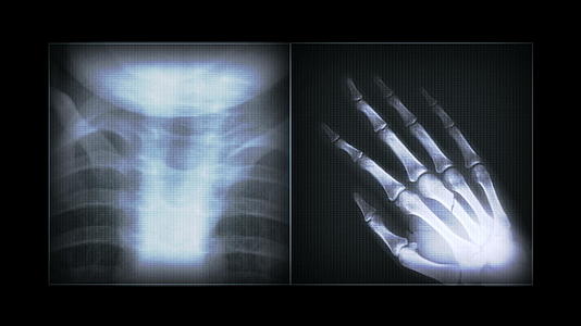X射线图像视频的预览图