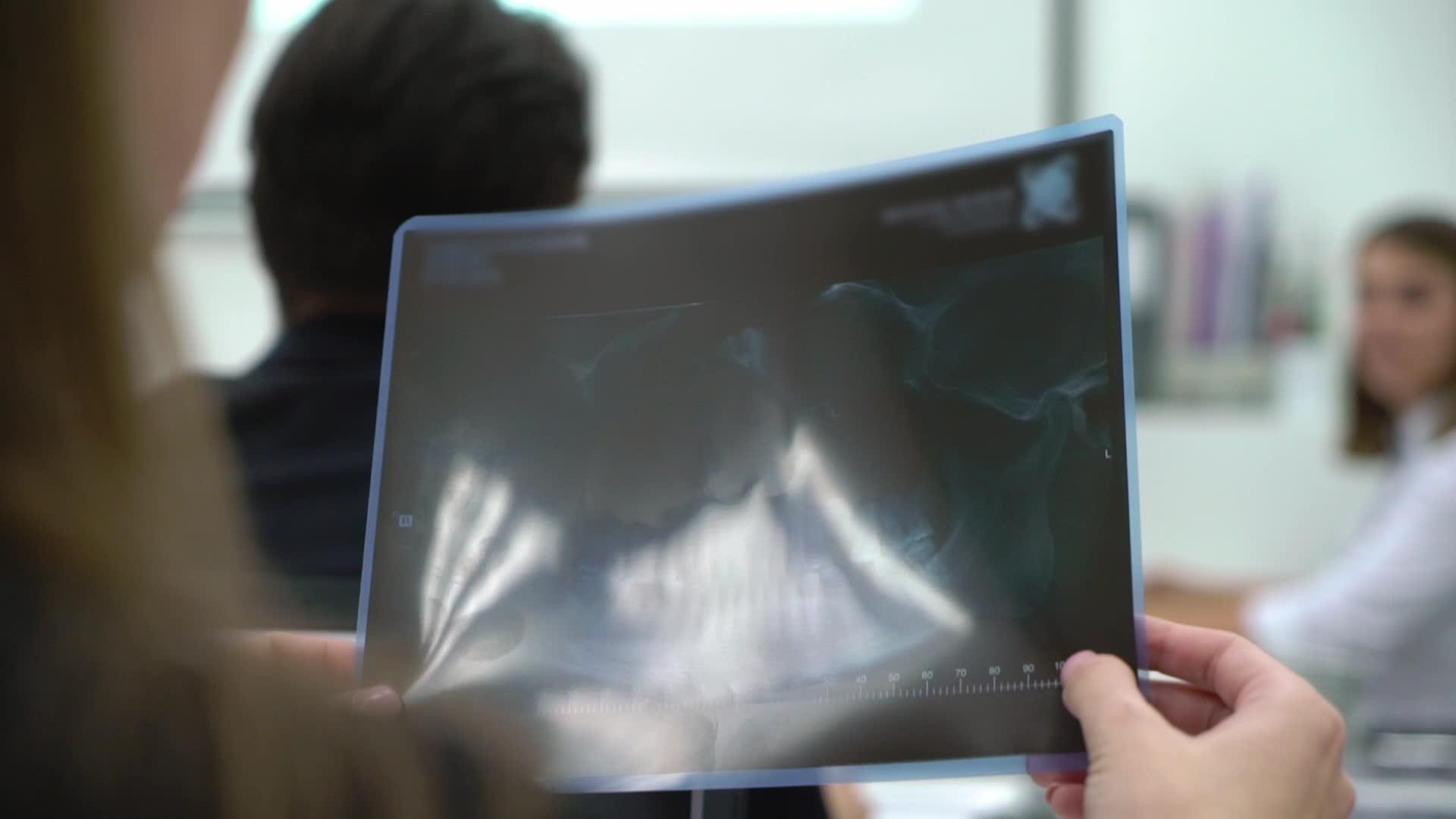 医学生医生持有牙齿和下巴x光片视频的预览图