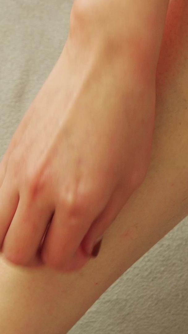 皮肤瘙痒皮肤干燥皮肤脱屑腿部皮肤病瘙痒皮肤过敏真菌感染视频的预览图