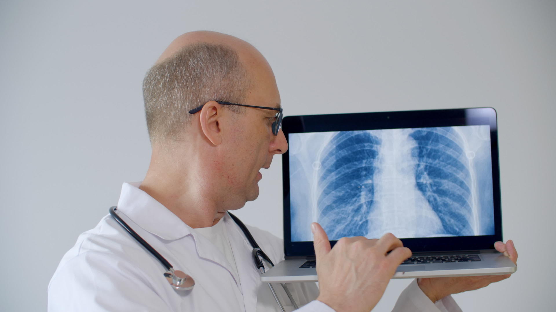 医生有一台电脑显示肺部光片视频的预览图