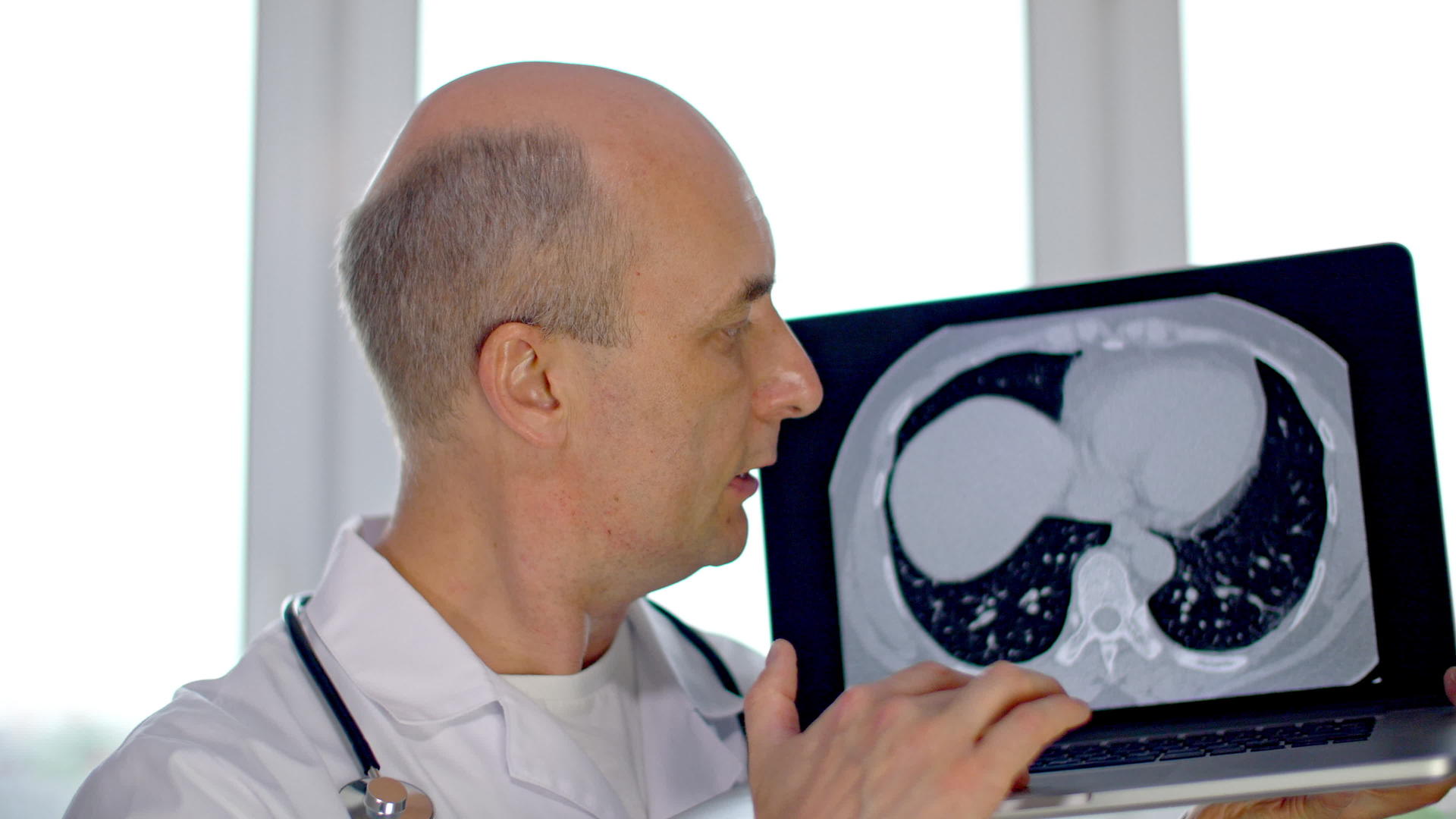 显示肺部Ct扫描视频的预览图