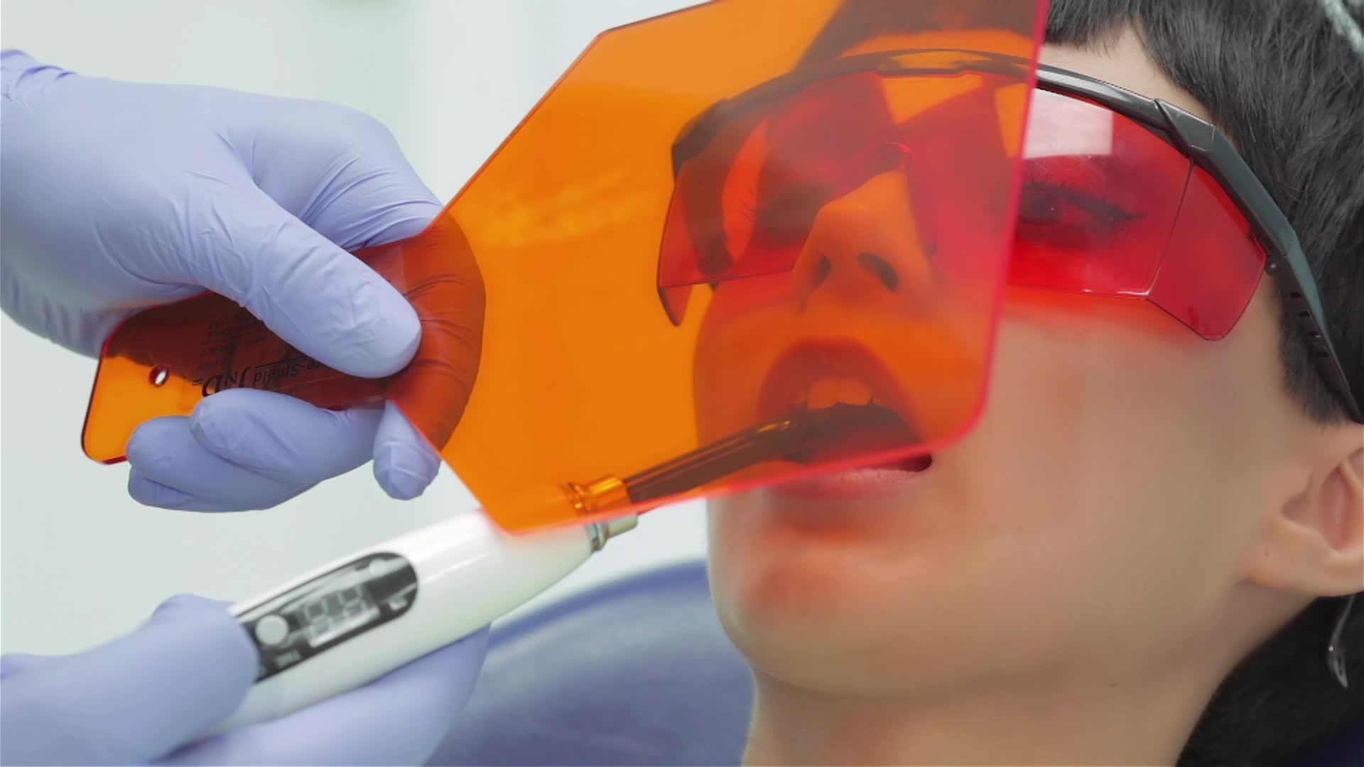 牙医牙齿时牙医用工具遮挡牙齿视频的预览图