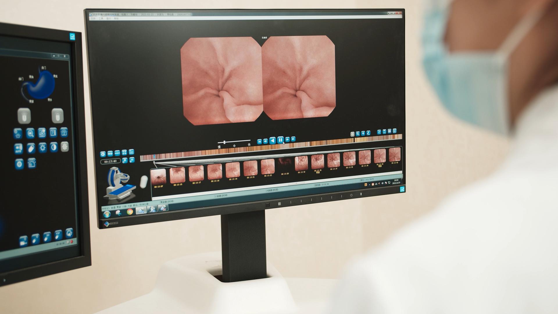4K实拍胃镜检查影像视频的预览图