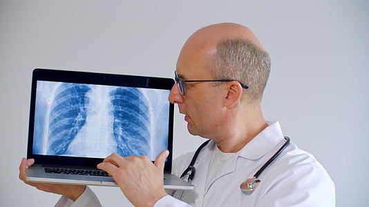 执业医生在笔记本电脑屏幕上显示执业医生CT扫描肺部男医生在远程笔记本屏幕上解释了肺部x射线图片视频的预览图
