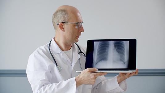 执业医生在笔记本电脑屏幕上显示肺荧光图片视频的预览图