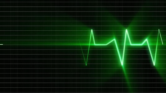 医疗监视器上的心脏脉冲序列视频的预览图