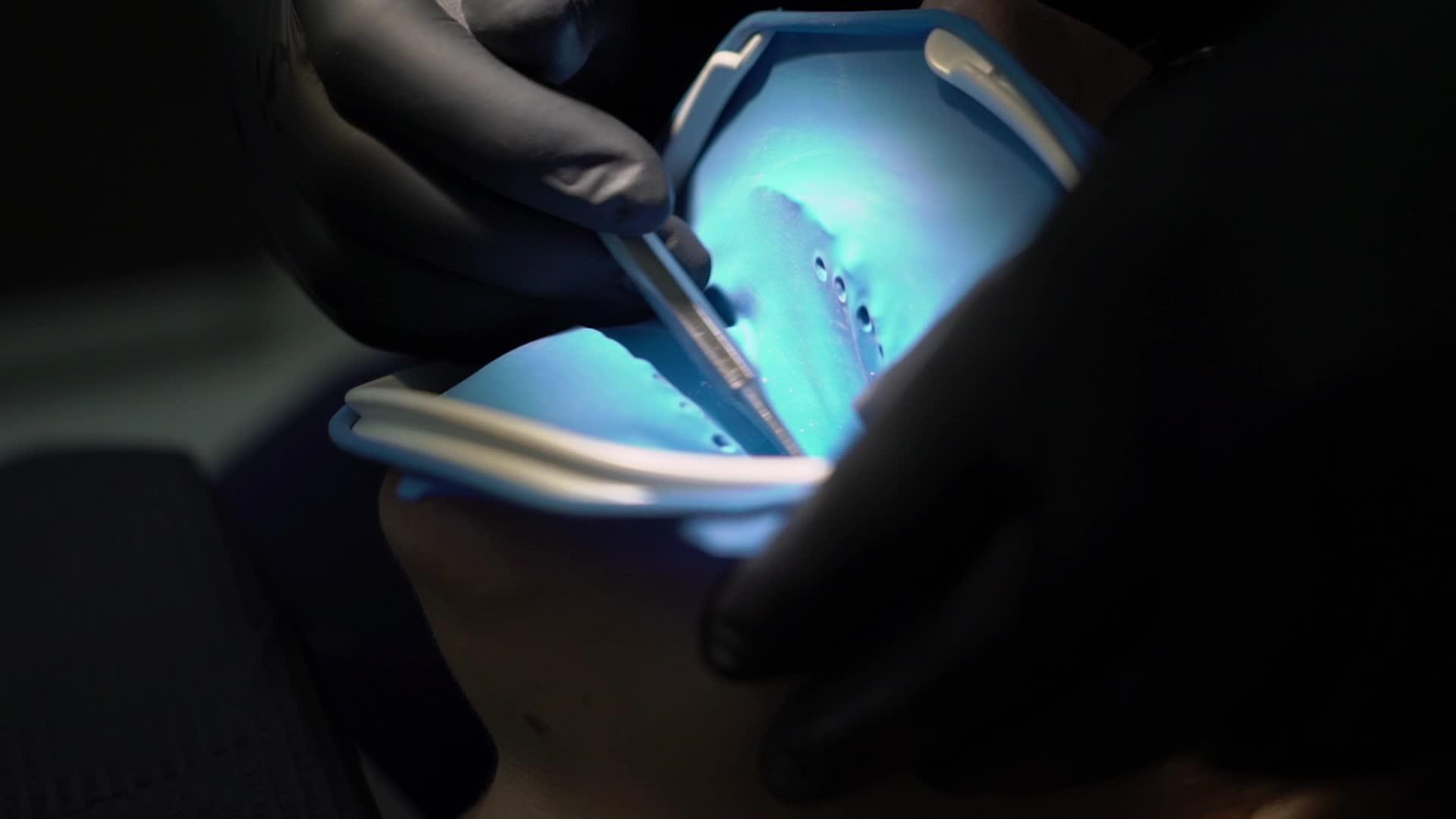 牙医在诊所为女性患者治疗牙齿视频的预览图