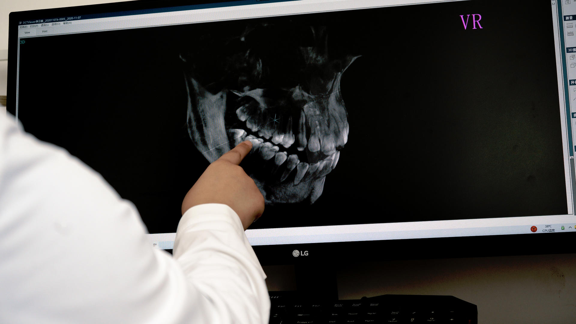 8k口腔科医生正在给病人看牙片视频的预览图