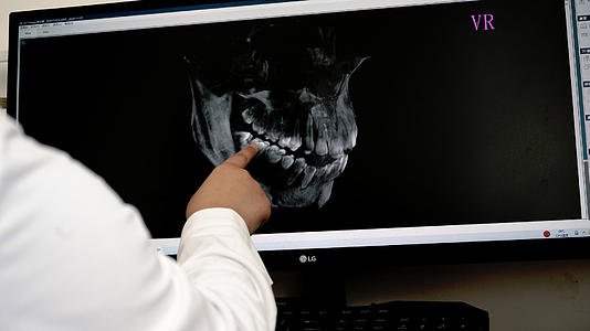 8k口腔科医生正在给病人看牙片视频的预览图