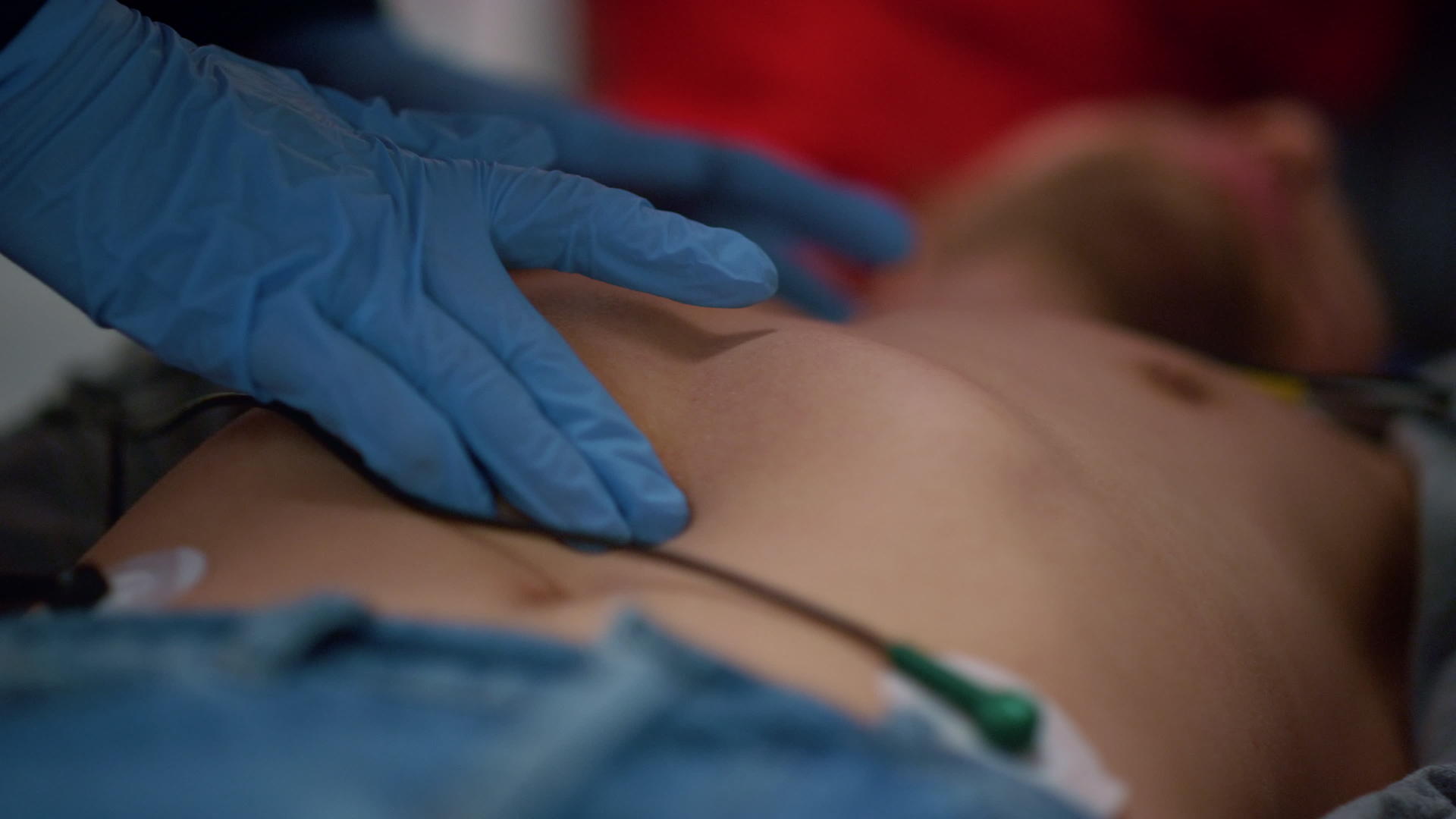 救护车医生在担架上为病人提供心血管按摩视频的预览图