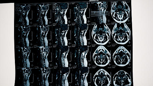 8k医院病人核磁共振片子视频的预览图