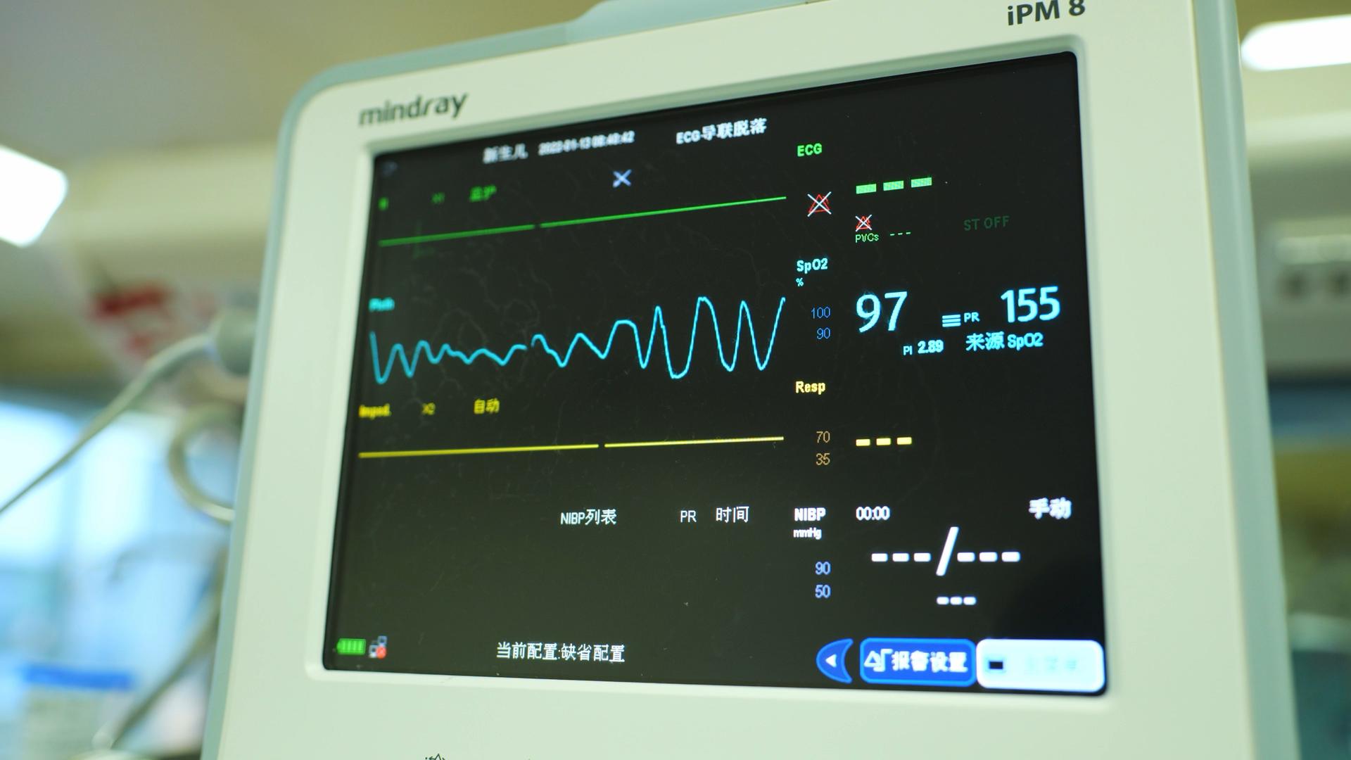 4K实拍医院ICU病房医疗仪器显示屏幕视频素材视频的预览图