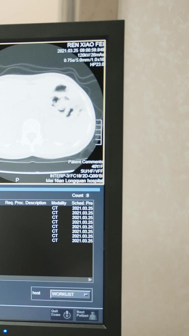 实拍医院CT医疗设备视频的预览图