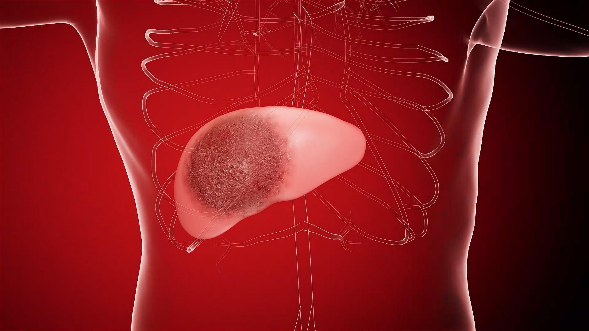 3d人体肝脏病变老动画的预览图