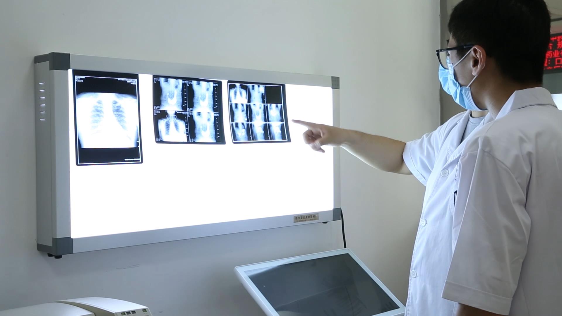 1080P医生检查X光片视频的预览图