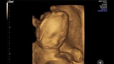 1080高清孕妇孕期怀孕胎儿检查四维彩超婴儿影像视频视频的预览图