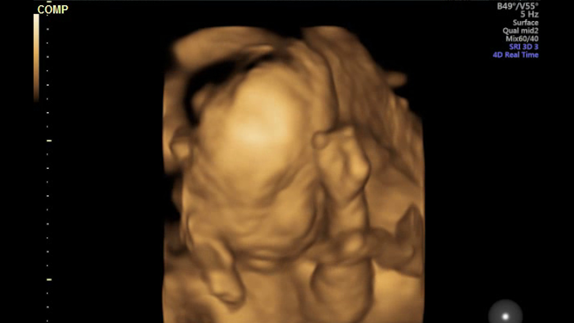 1080高清四维彩超孕妇孕期检查婴儿影像视频视频的预览图