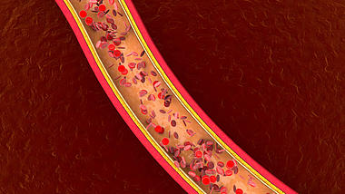 3D医学血管内血液流动视频素材视频的预览图