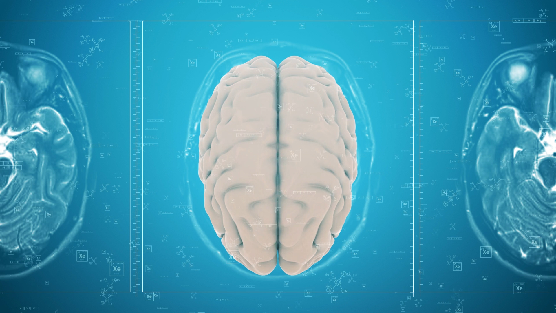 3D医疗化学生物脑部背景视频AE模板视频的预览图