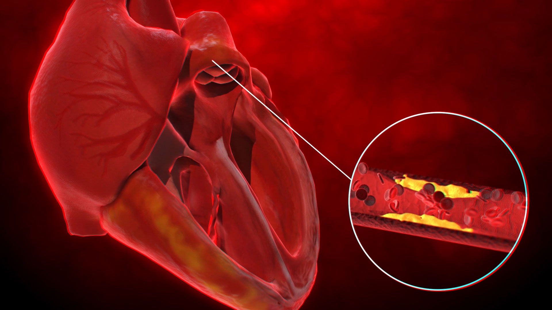 心脏3D医疗人体通道视频素材视频的预览图