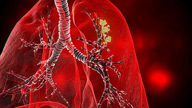 肺部人体医疗视频素材视频的预览图