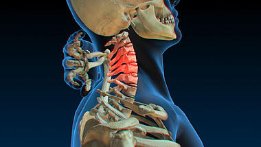 颈椎医疗视频素材模板视频的预览图