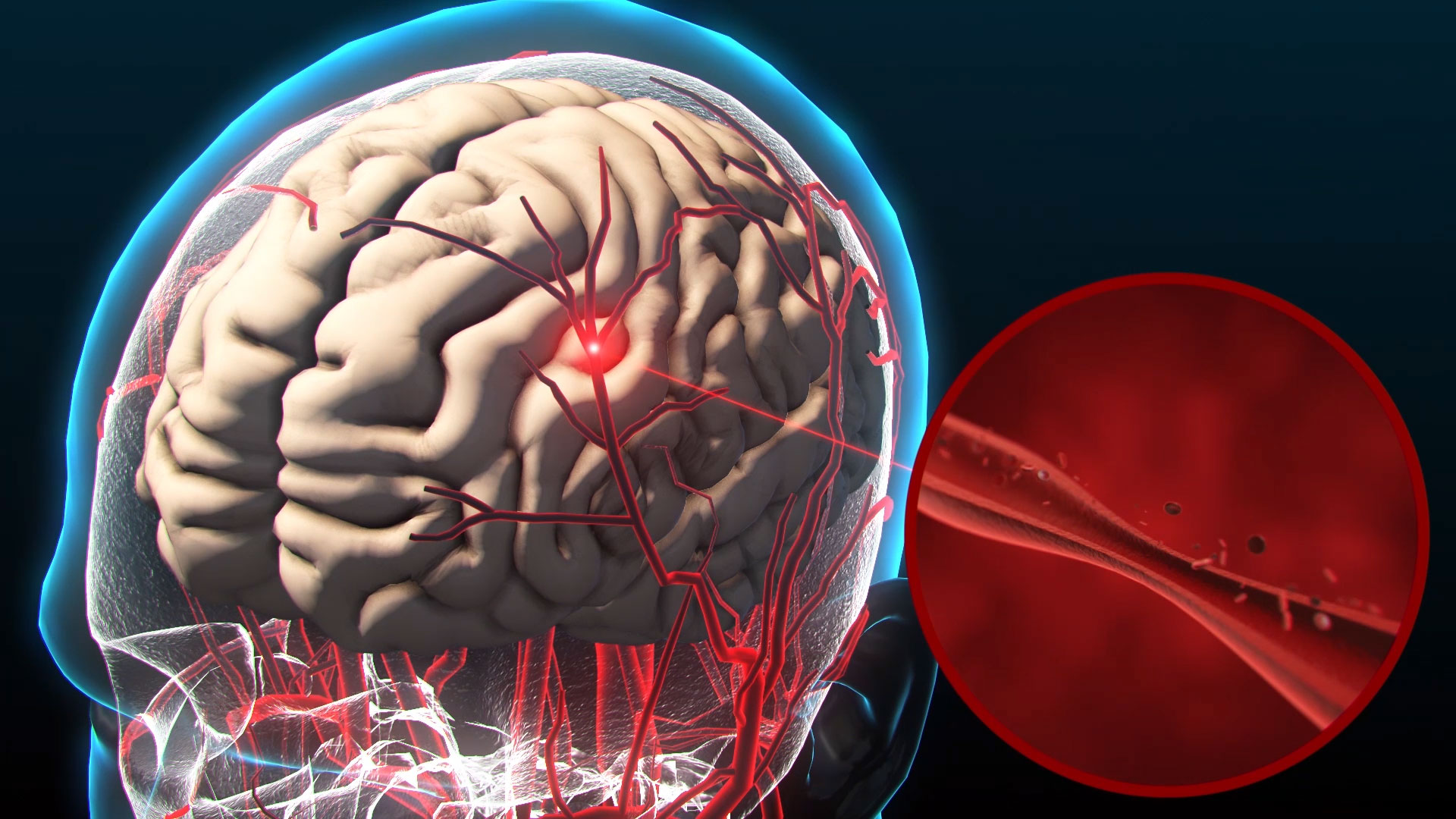 大脑人体医疗视频素材AE模板视频的预览图