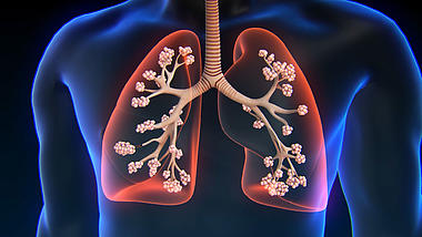 医疗肺部3D视频素材模板视频的预览图