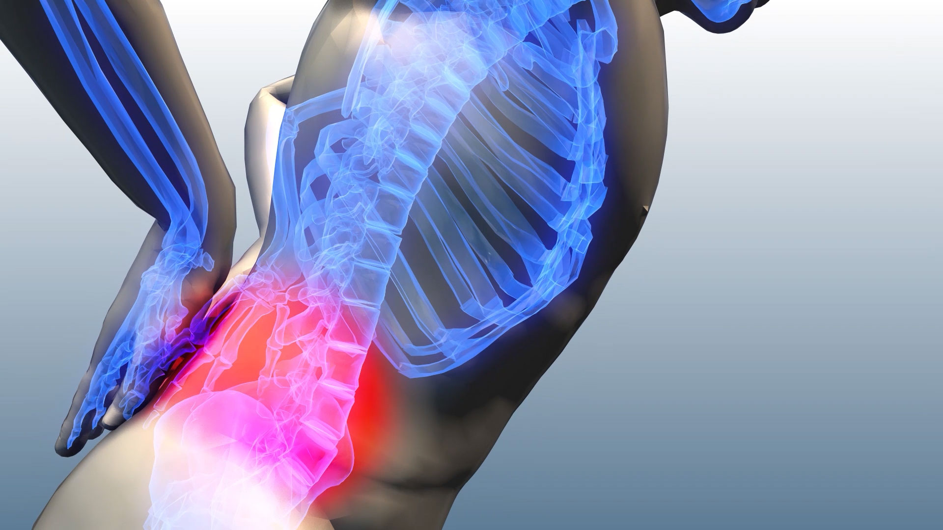 腰椎疼痛背景视频3D视频素材视频的预览图